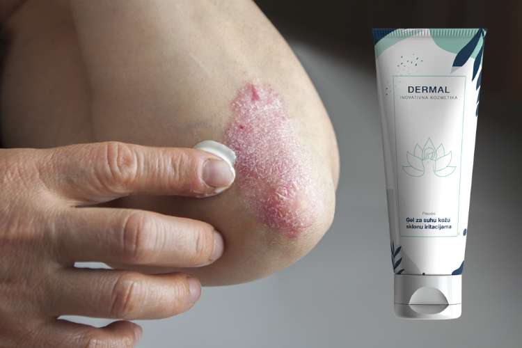 Dermal cena